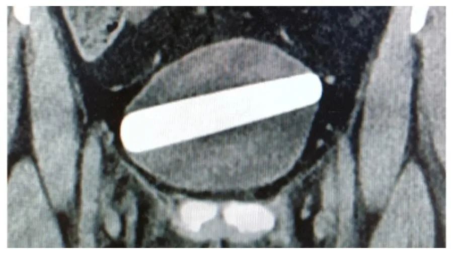 o-vibrador-de-10-cm-de-comprimen