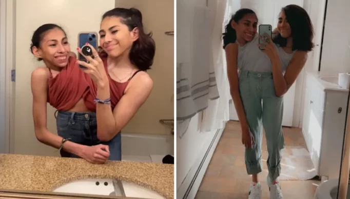 conheca-as-gemeas-siamesas-que-fazem-sucesso-no-tiktok