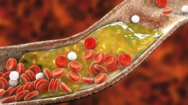 conheca-bebidas-que-sao-verdadeiras-armas-contra-o-colesterol-alto-0a8f5d32-74e2-433c-940d-1b9d65d24769