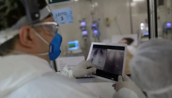 radiografia-de-torax-coronaviruscovid-19-hospital-sao-paulo1205200326-1688507473-1-1140x682