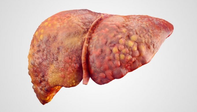 istock-477578412-910x682