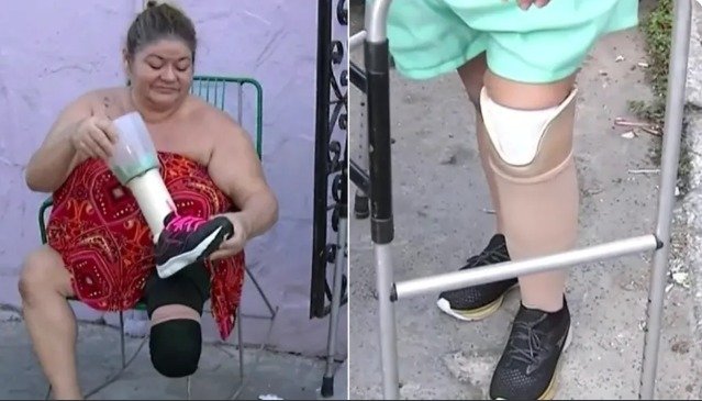 mulher-usa-protese-nova