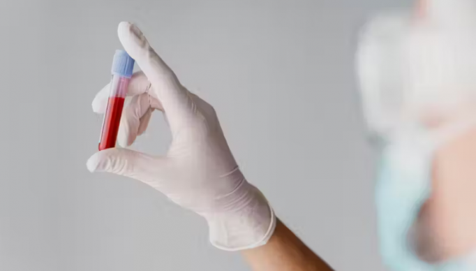 Screenshot 2023-09-20 at 16-23-02 Chega ao Brasil 1º exame de sangue que detecta Alzheimer como funciona - Só Notícia Boa