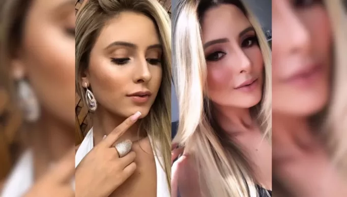 Izadora-antes-e-depois-dos-procedimentos