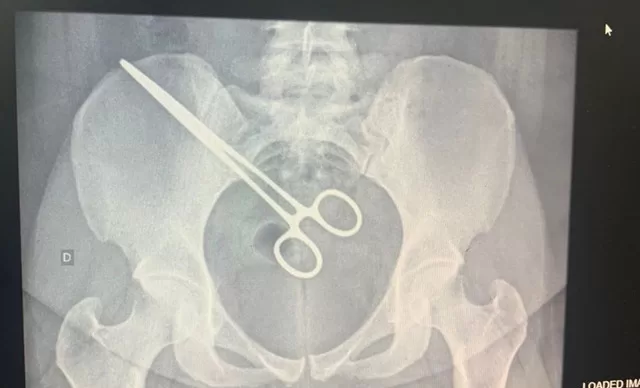 a8e6132d8580efac3b1f60f4f406c881