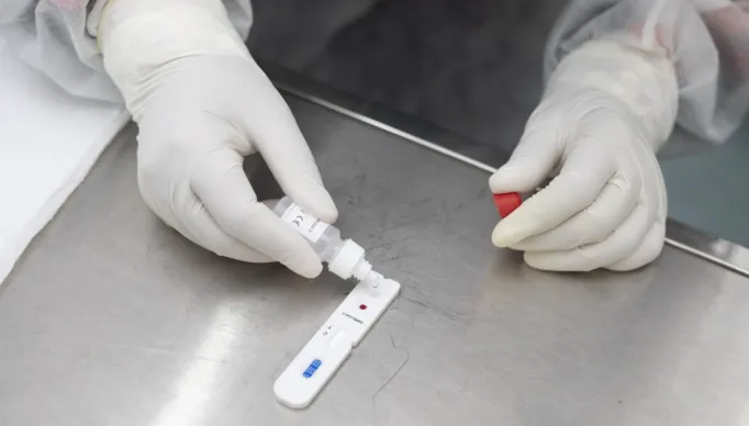 testes-covid-ceara_Easy-Resize.com_