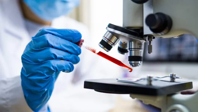 Teste-sangue-exame-leucemia-laboratorio