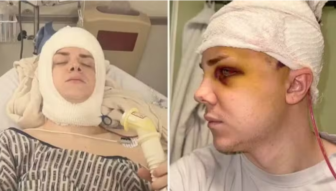 Screenshot 2024-01-25 at 17-56-20 Paciente tem o crânio removido para lavagem do cérebro após contrair infecção hospitalar