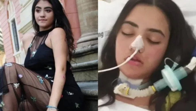 Dengue-neurologica-cerebro-Poly-Matias-5