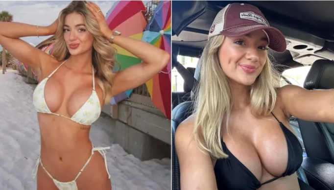 Screenshot 2024-02-22 at 15-54-58 Vítima de ataque de tubarão investe na carreira de modelo erótica 'Cicatriz fascina'