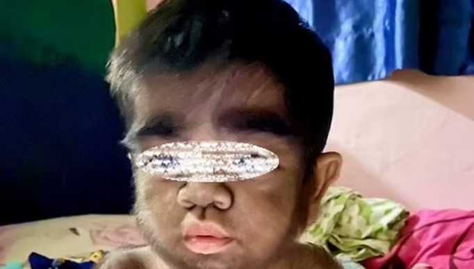 Screenshot 2024-04-11 at 18-47-27 Mulher diz que filho 'lobisomem' nasceu com síndrome rara por ela ter comido gato quando estava grávida