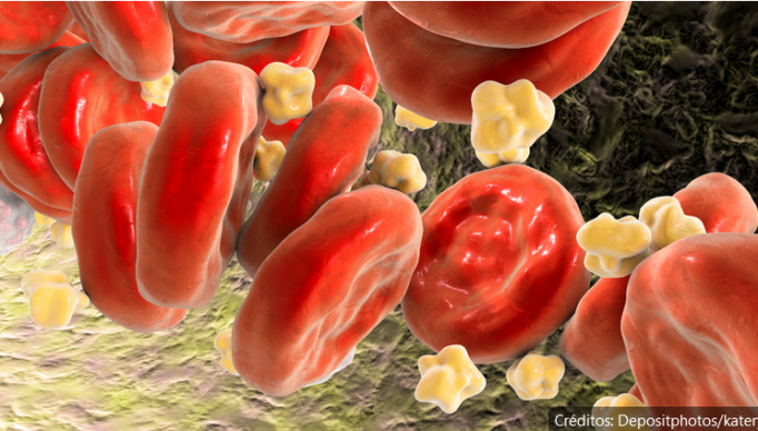 Screenshot 2024-04-21 at 21-33-30 Harvard revela os 5 melhores alimentos para reduzir o colesterol