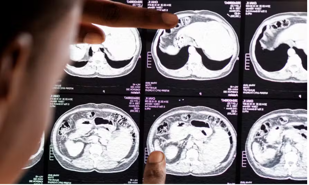 Screenshot 2024-06-09 at 12-46-22 Demência cientistas criam exame simples de 6 minutos que pode detectar quadro até 9 anos antes dos sintomas